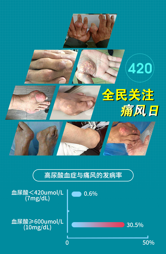420全民关注痛风日:治疗痛风,重在慢病管理暨名医工作室丨北京